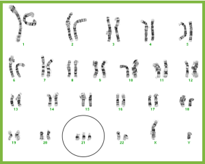 trisomy-21-chromosome-chart